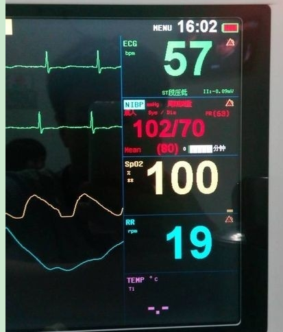 (2分钟介绍)“心跳炸金花能安装开挂软件吗!其实确实有挂