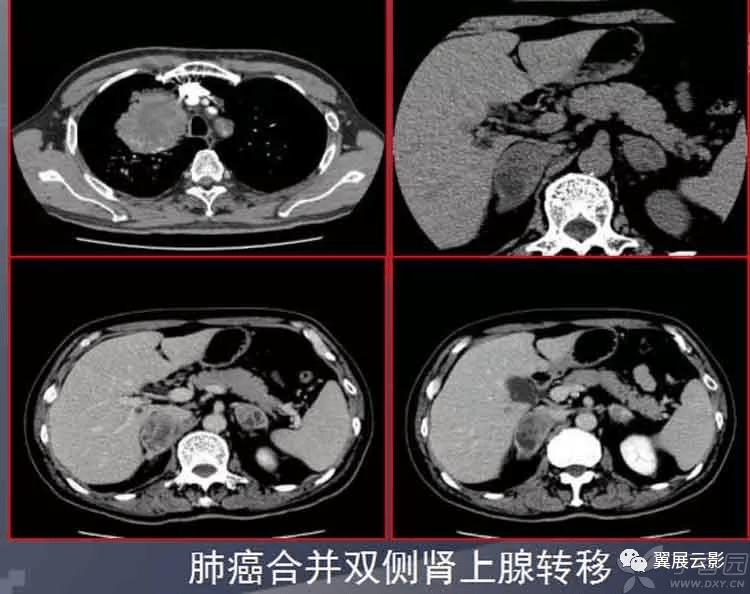 三分钟了解&quot;CT看穿仪怎样看穿硬币的正反面—详细解说+新浪科技