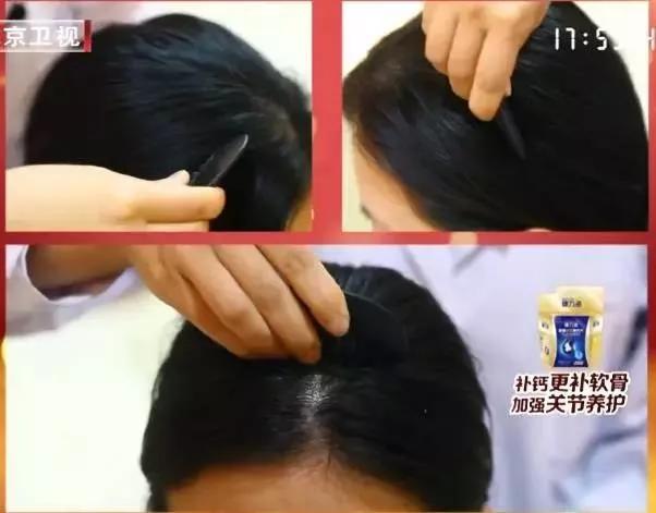 优选推荐“透视毛巾木棍筷子缺口_《爱问知识人 使用说明》