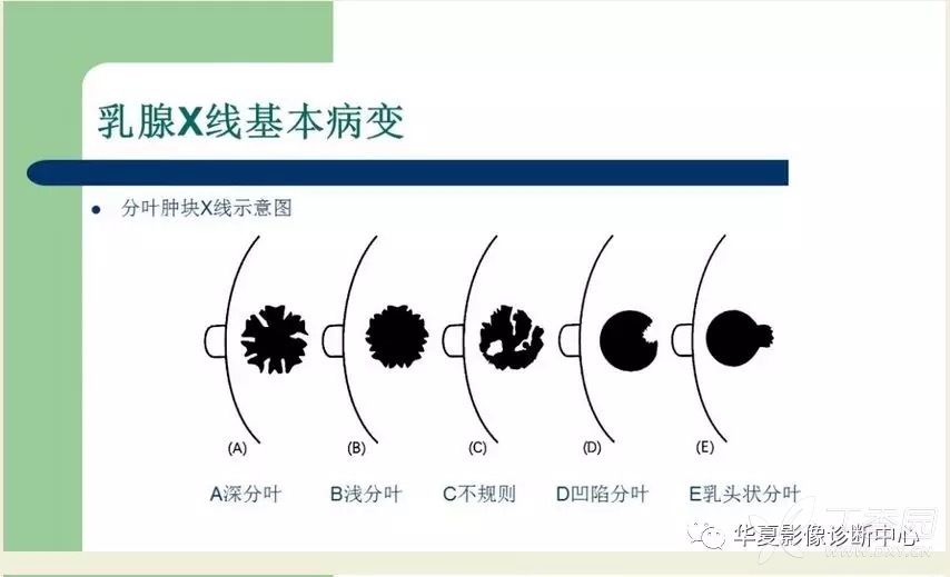 3分钟教你科普“如何透视押宝里色子的点数一《我来教教你怎么赢 》